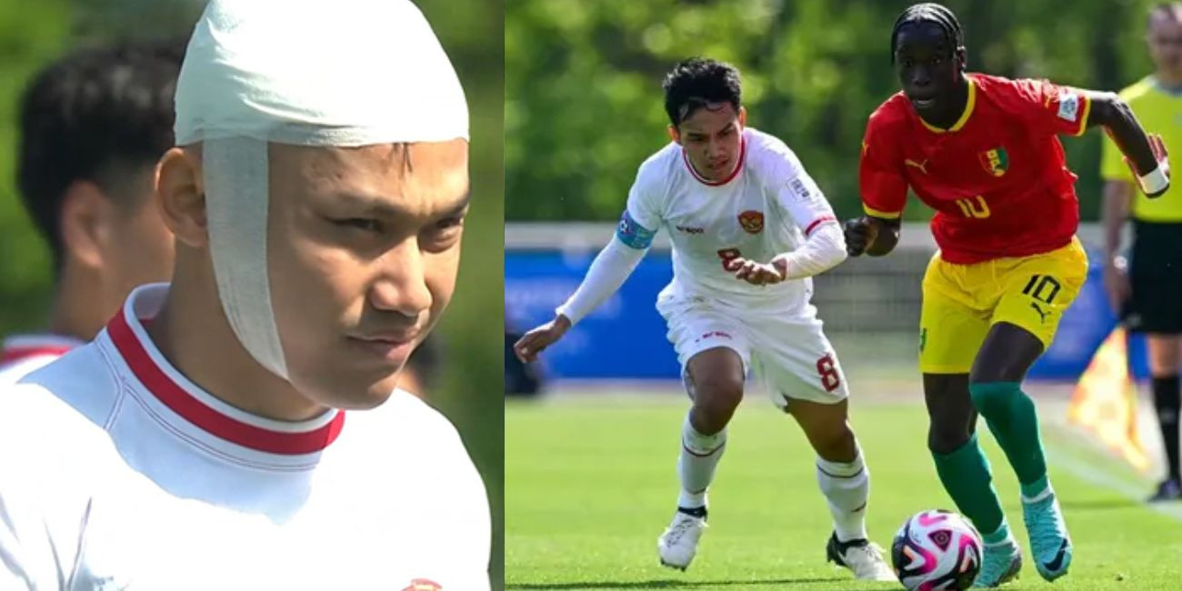 Kepala Witan Sulaeman Diperban saat Timnas Indonesia U-23 Vs Guinea Viral, Sang Istri : Ini Bukan Lelucon!